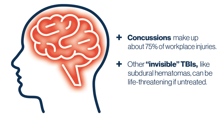 Concussions make up about 75% of workplace injuries. Other "invisible" TBIs, like subdural hematomas, can be life-threatening if untreated.