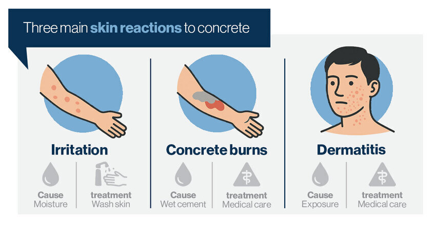 Chart showing the three main skin reactions to concrete. 